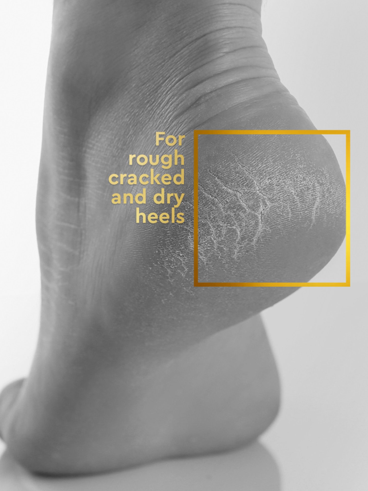 VLCC Clinic Heel Repair Cream - 100 gm