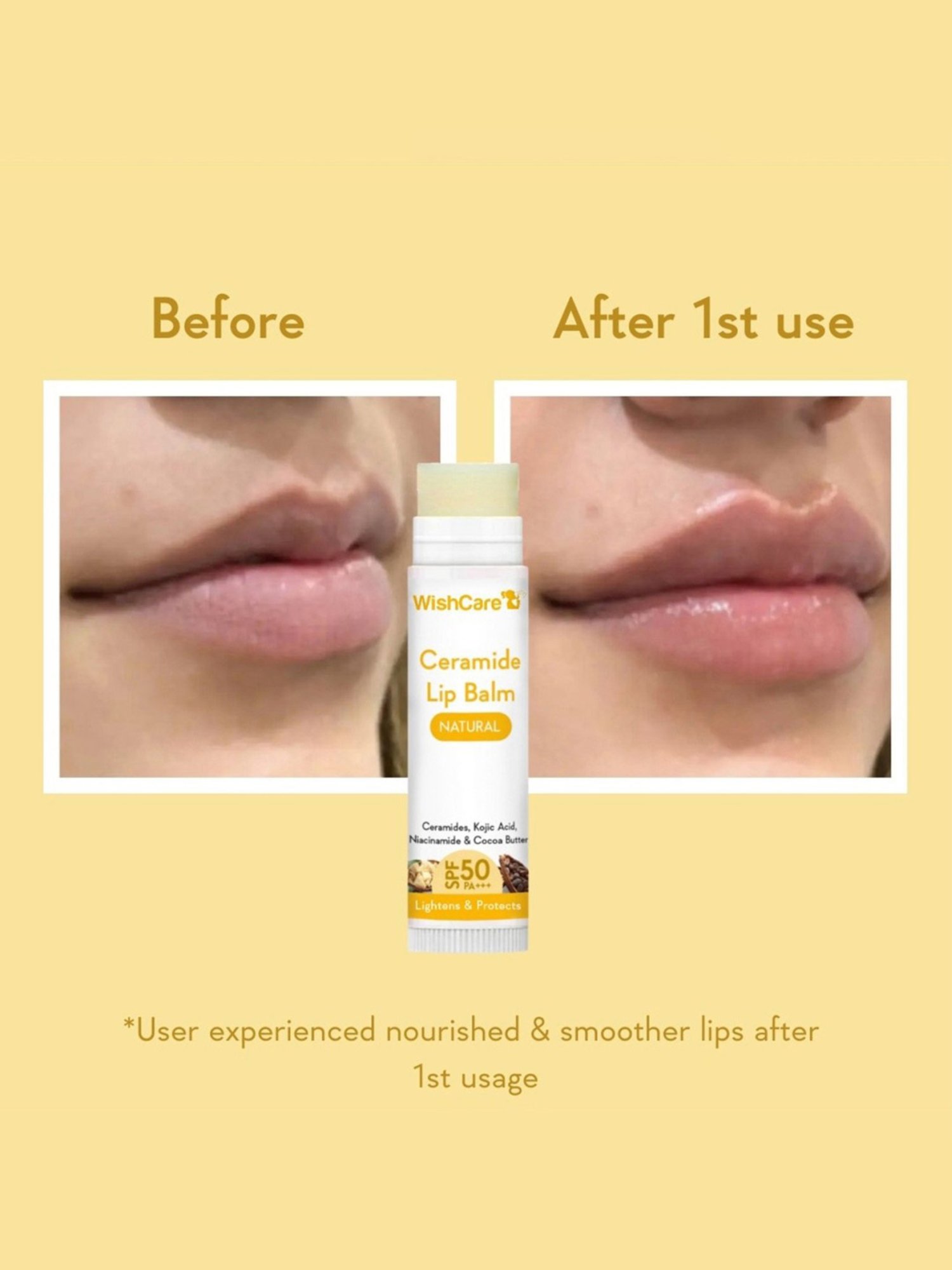 Wishcare Natural Ceramide Lip Balm SPF 50 PA+++ - 5 gm