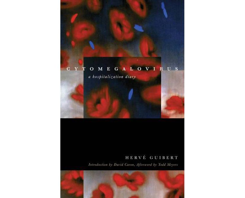 Cytomegalovirus - (Forms of Living) by  Herv'e Guibert (Paperback)