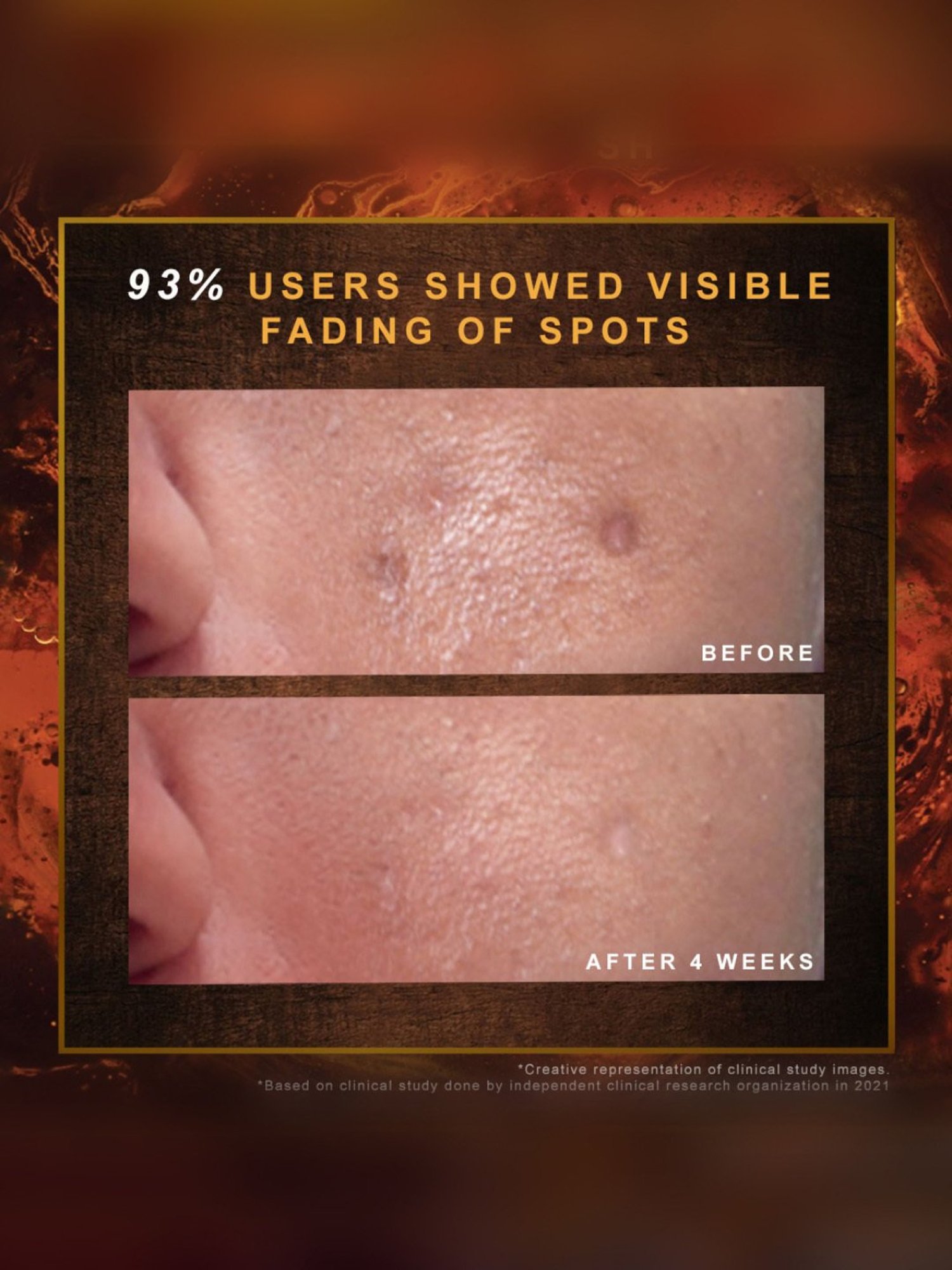 Indulekha Ayurvedic Proprietary Medicinal Soap - Pack of 3