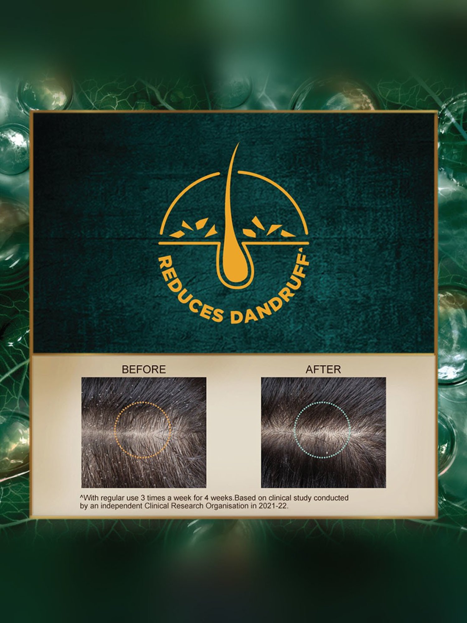 Indulekha Dandruff Treatment Shampoo - 580 ml