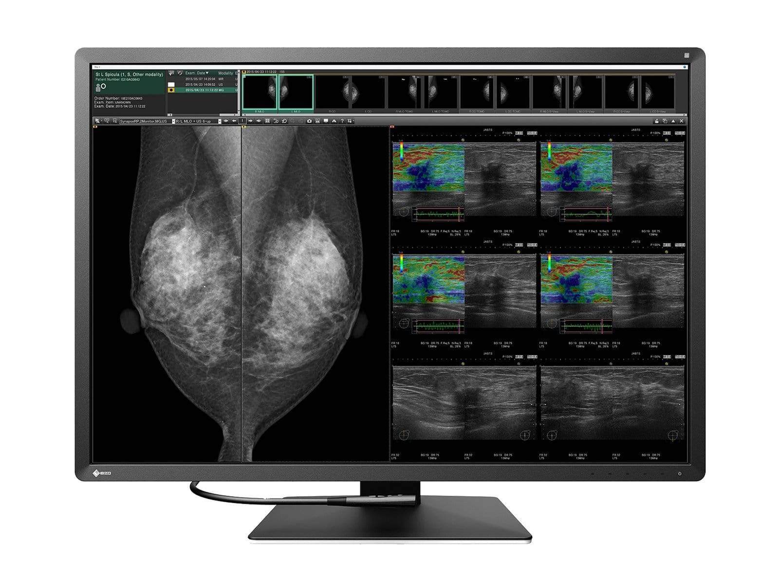 Eizo Radiforce RX1270 12MP 31'' Color Medical Display Mammography Monitor (RX1270)