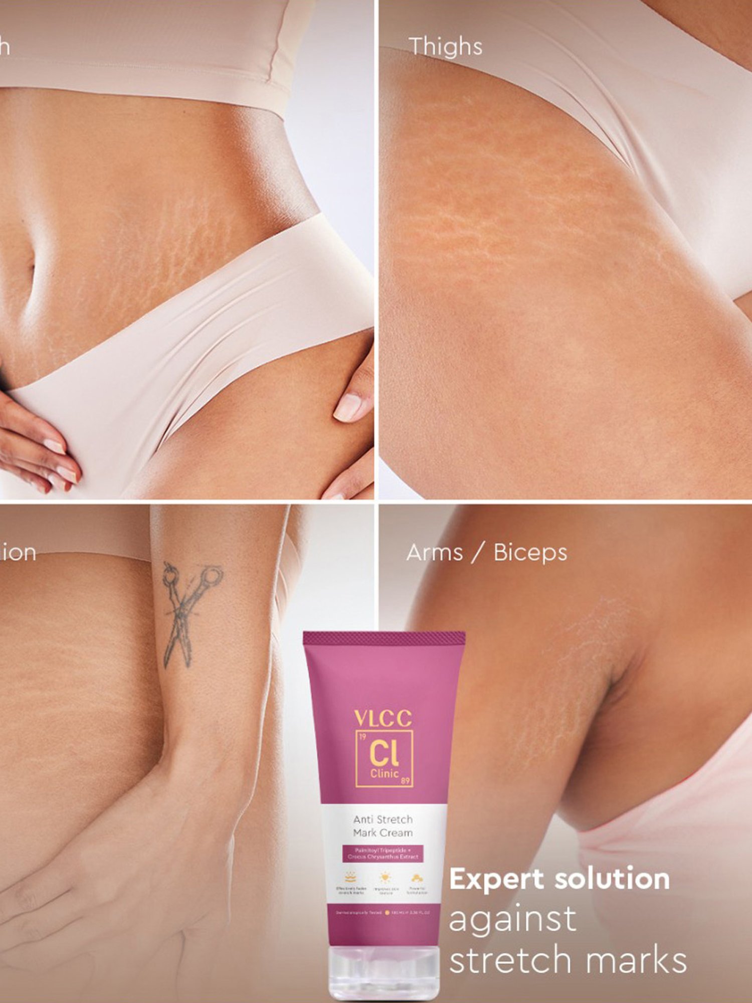 Mom & World Skin Bio Therapy Oil For Stretch Marks - 200 ml