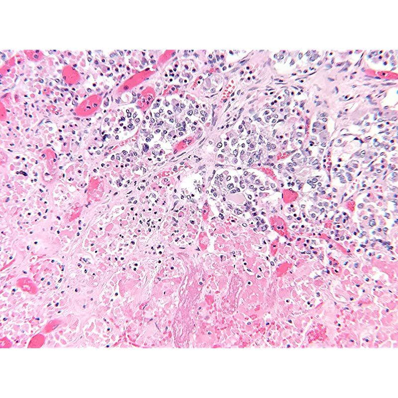 Microscope/Telescope Adapter for iPhone X