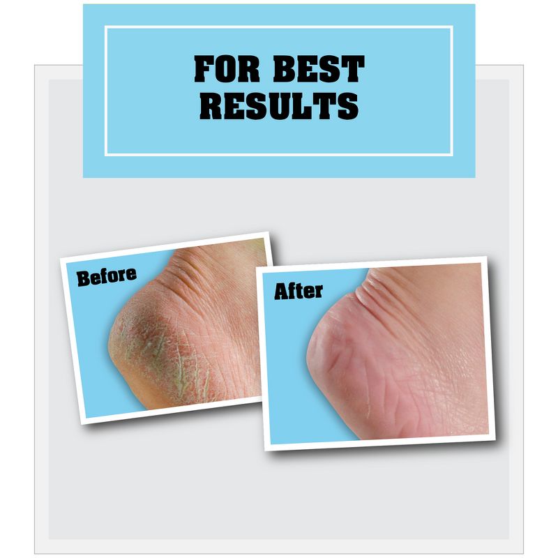 O'Keeffe's Healthy Feet Foot Cream - 3oz