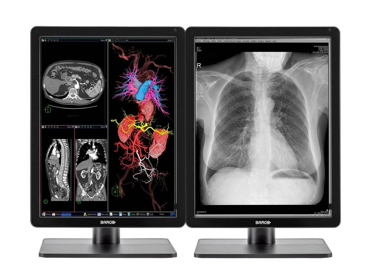 Pair (x2) Barco Nio MDNC-3421 3MP 21'' Color LED General Radiology PACS Display (K9300340A)