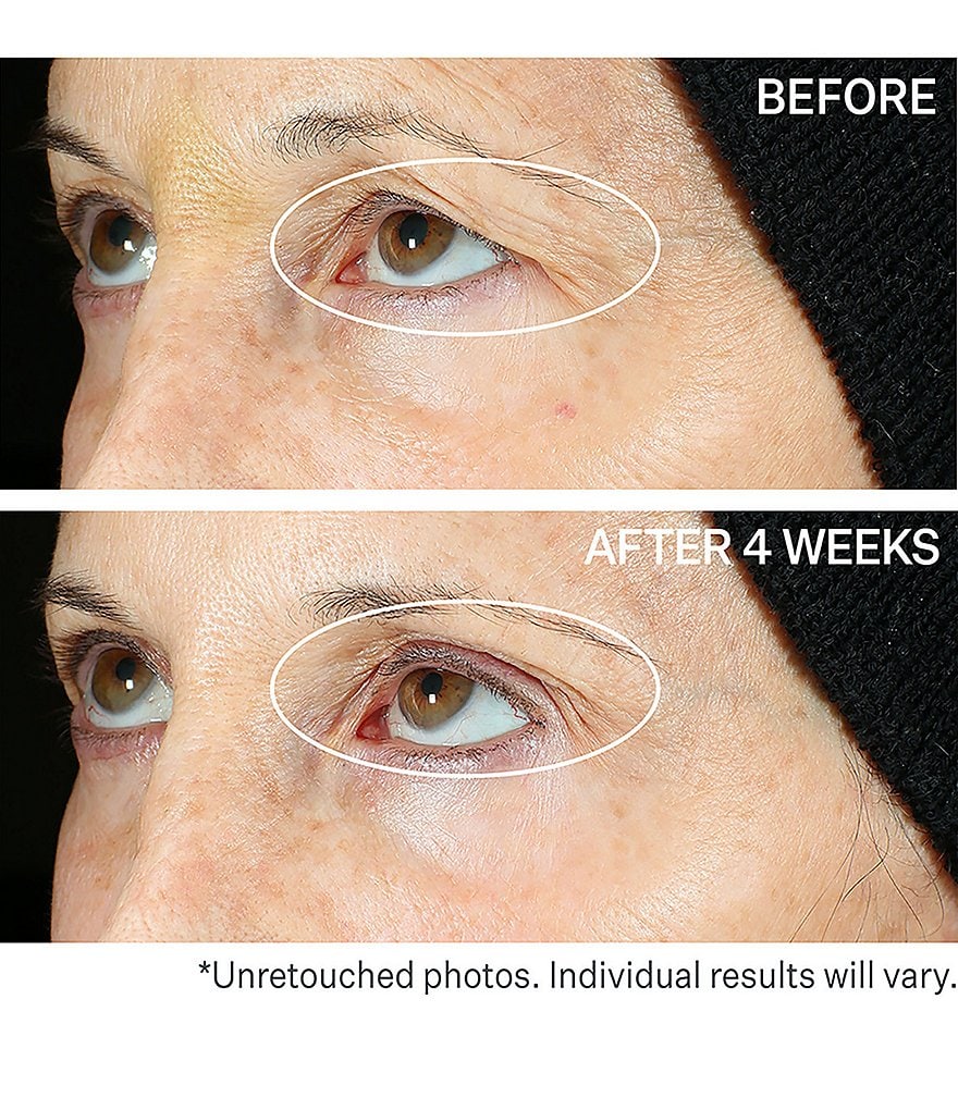 StriVectin Peptight&trade; 360&deg; Tightening Eye Serum