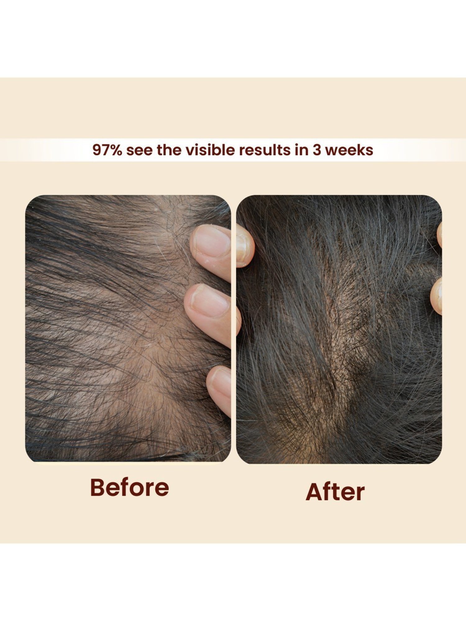 Earthraga Onion Hair Cleansing Shampoo - 300 ml