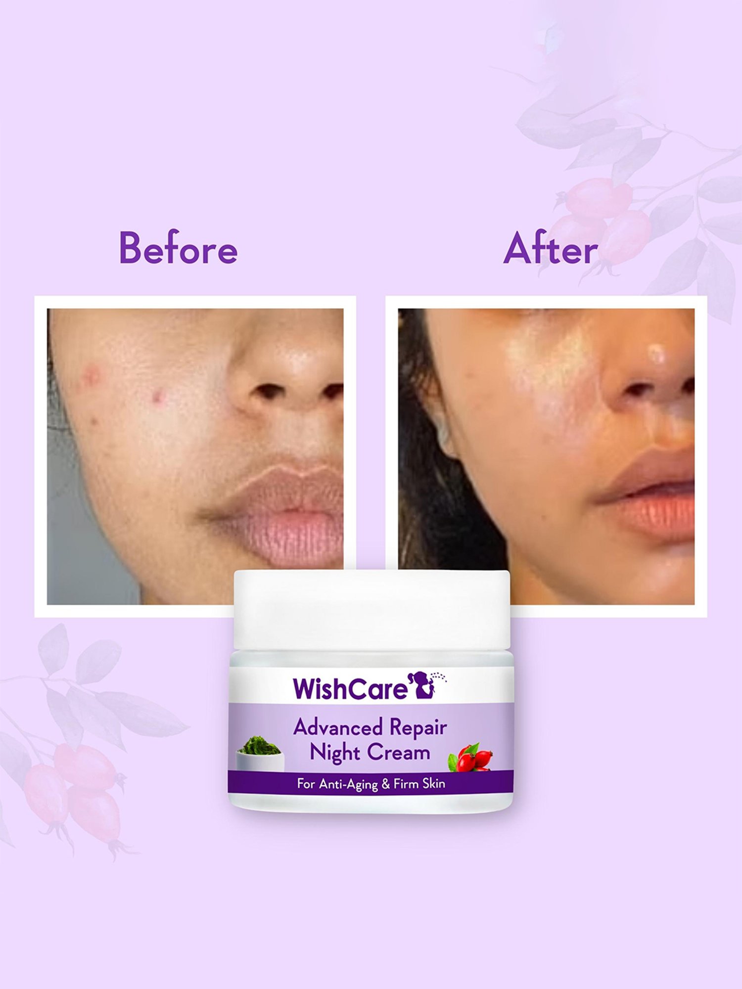 Wishcare Advanced Repair Night Cream - 50 gm