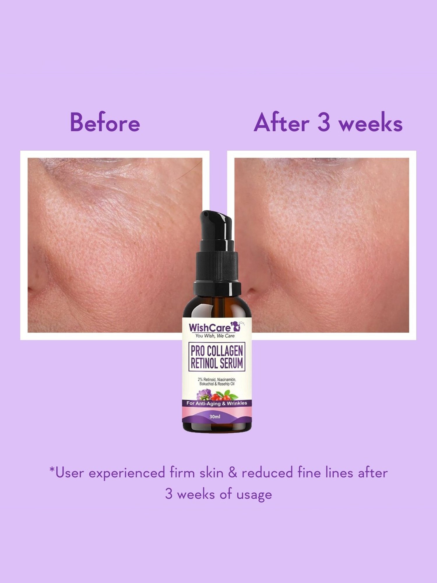 Wishcare Pro Collagen Retinol Serum - 30 ml