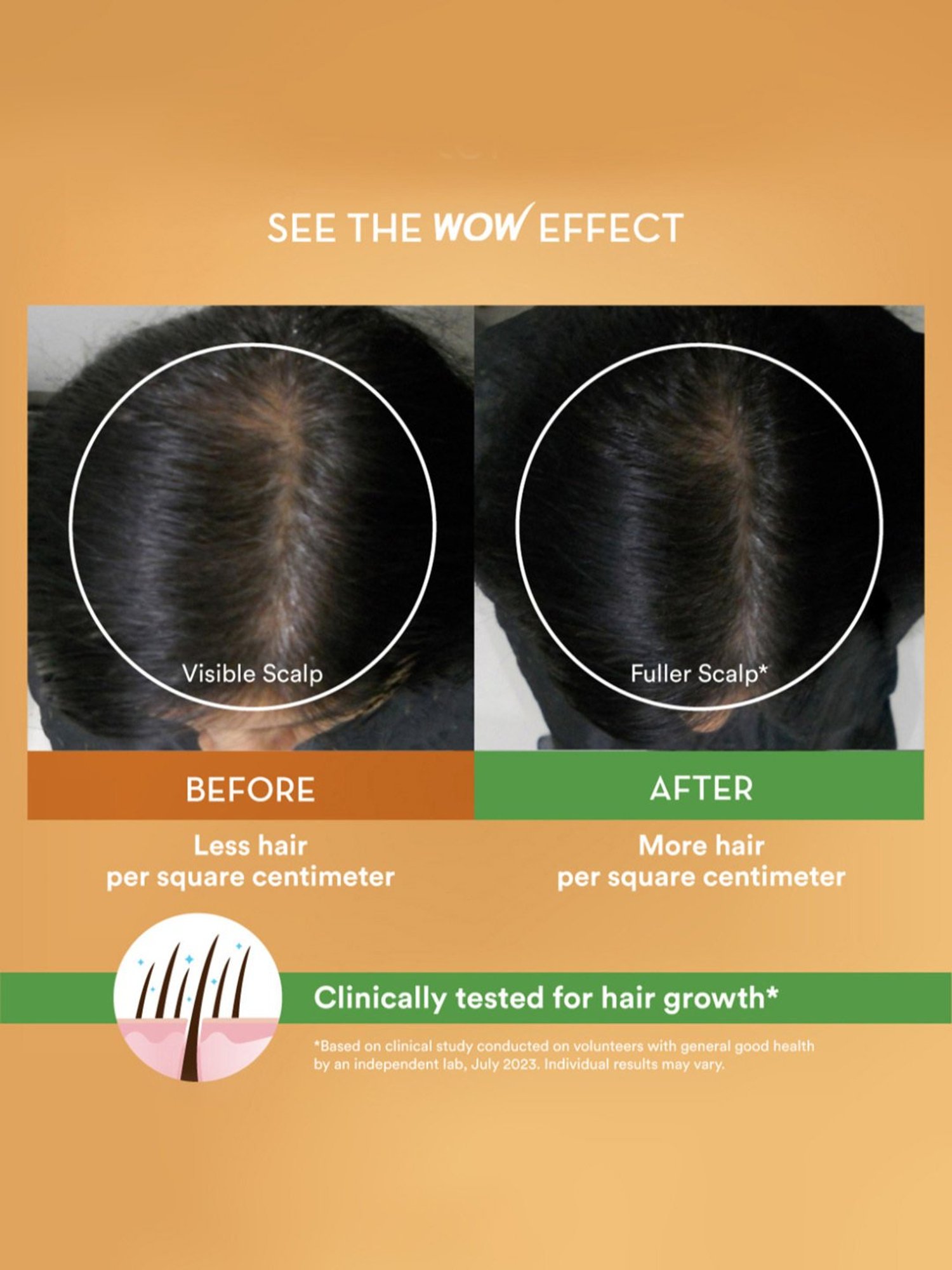 WOW Skin Science Rosemary with Biotin Shampoo - 250 ml