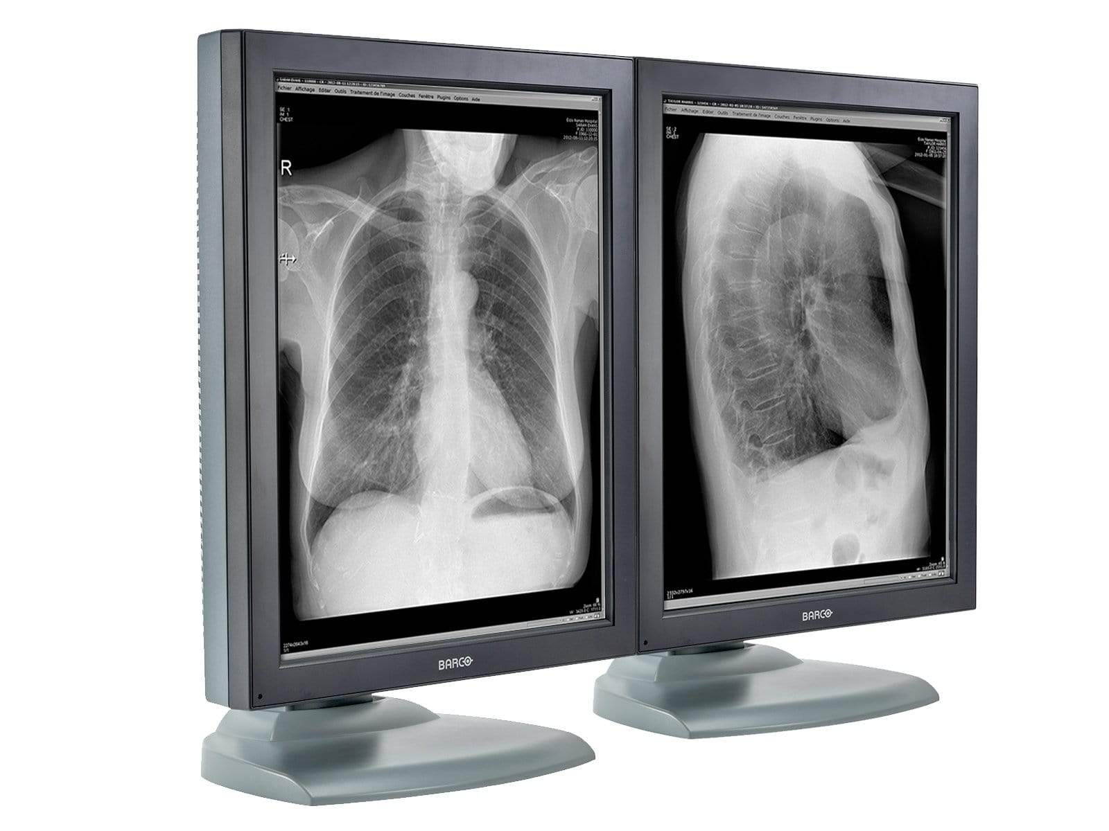 Pair (x2) Barco Nio MDNG-2121 2MP 21'' Grayscale Medical Diagnostic Radiology Monitor (K9601651)