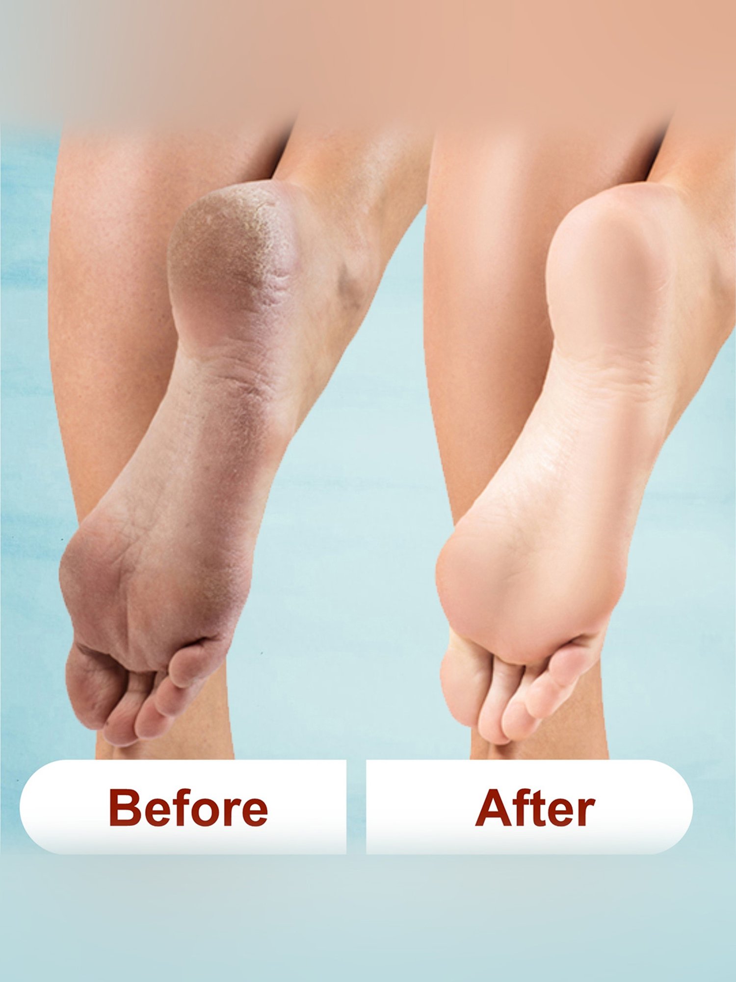 Kazarmaa Tea Tree & Lemon Foot Scrub with Scrubber Tools - 100 gm