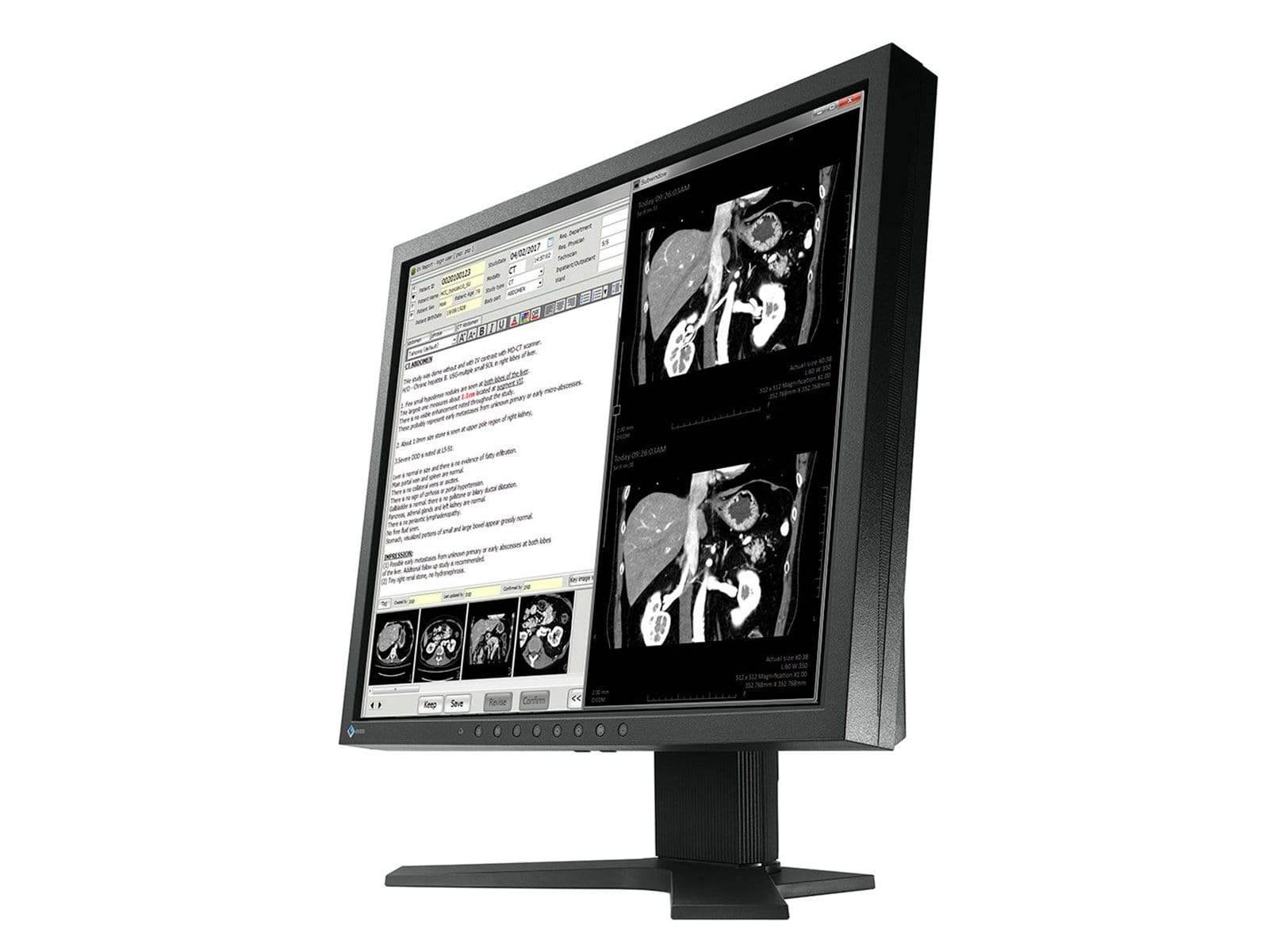 Eizo Radiforce MX194 1MP 19'' Clinical Review Monitor (MX194)