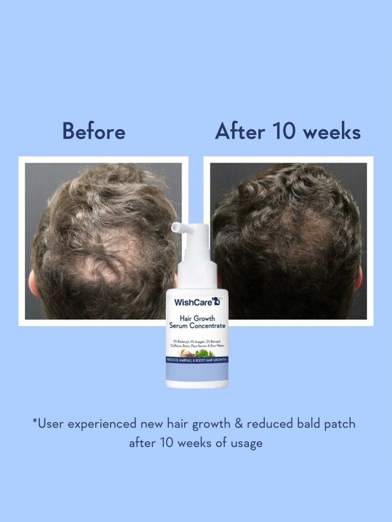 Wishcare Hair Growth Serum Concentrate - 30 ml