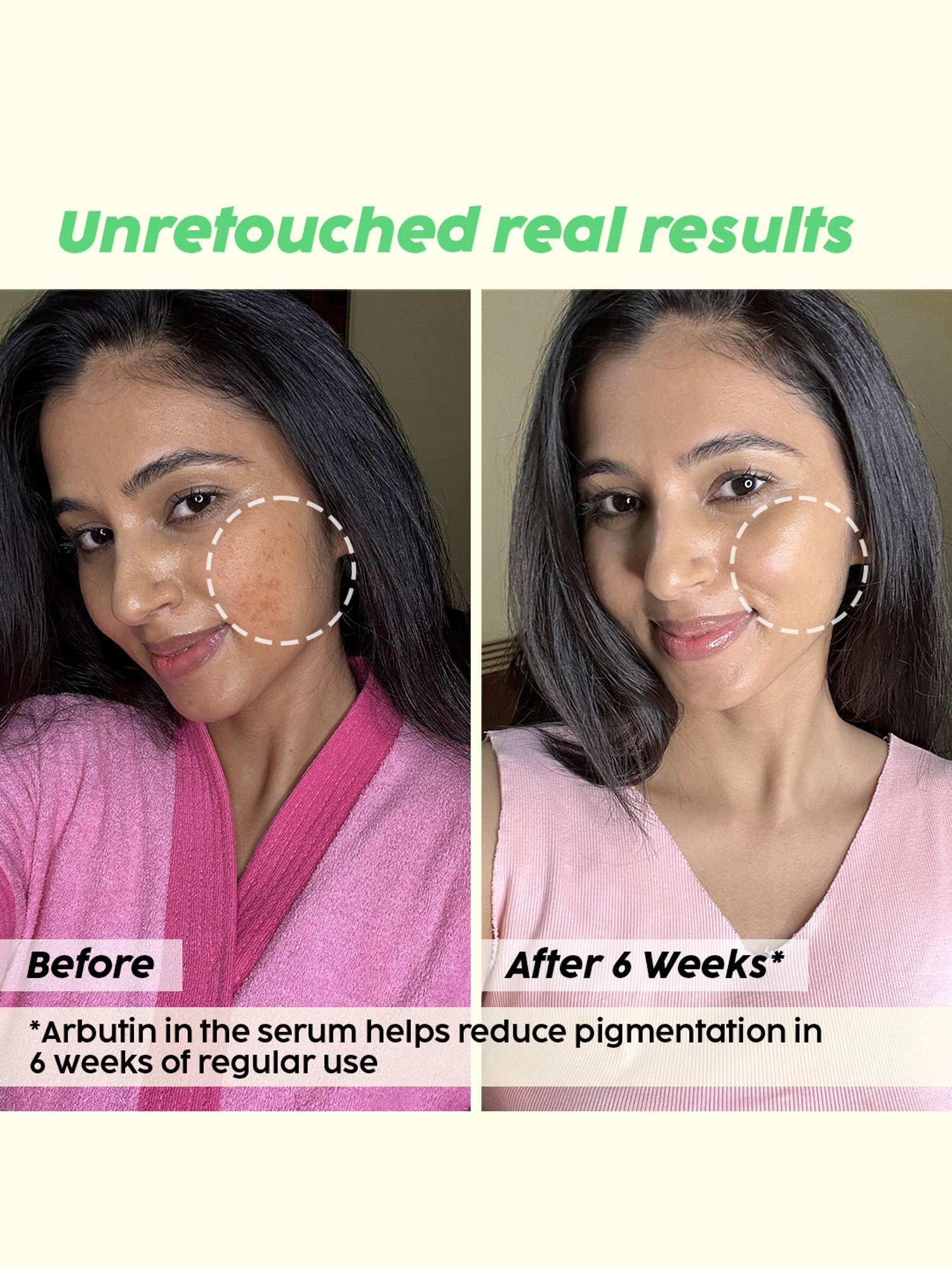 PLIX THE PLANT FIX Pineapple De-Pigmentation Juicy Facewash - 100 ml