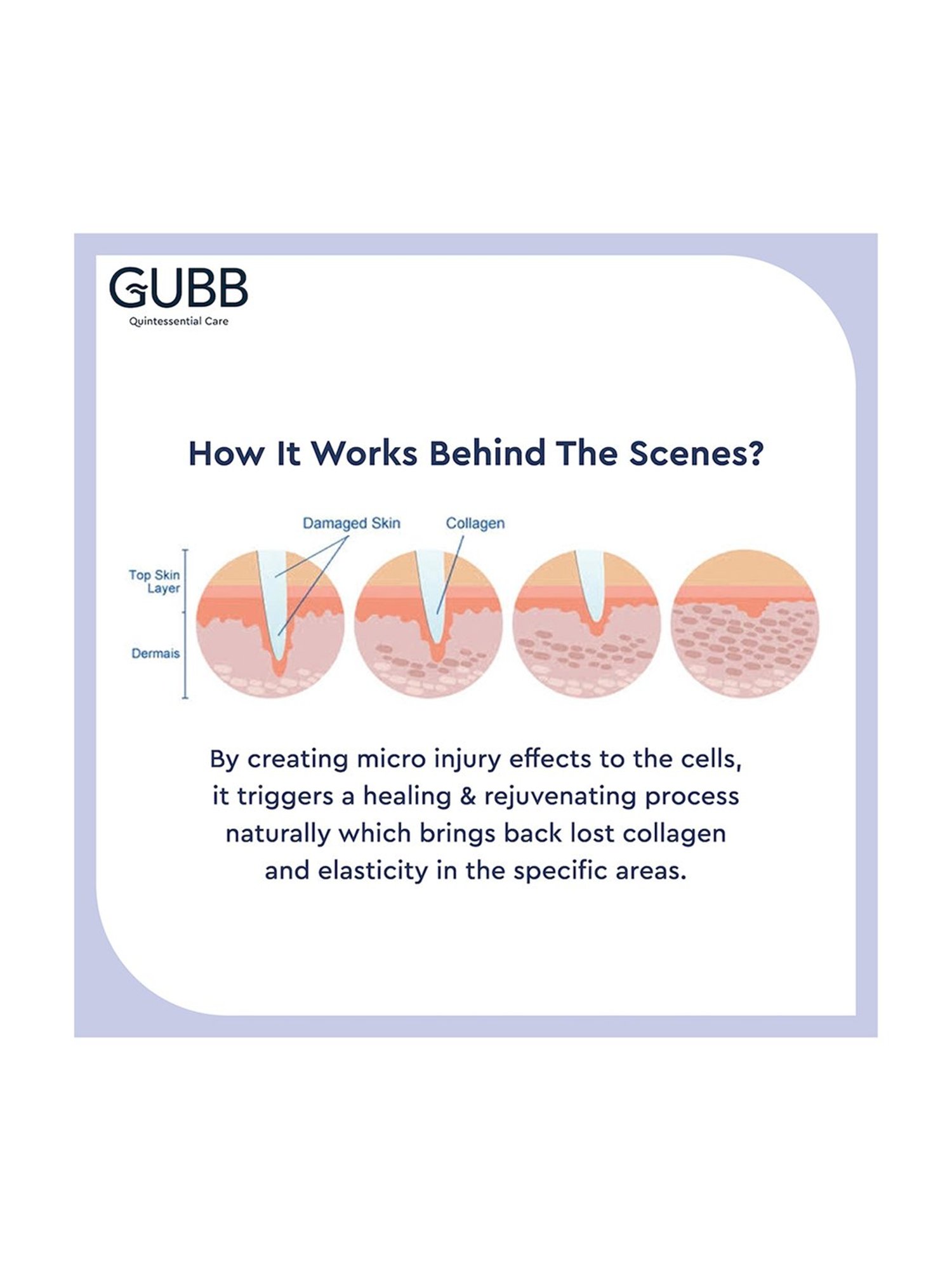 GUBB Derma Roller 0.5mm for Hair Regrowth & Skin Aging, 540 Micro Needles Roller - Blue