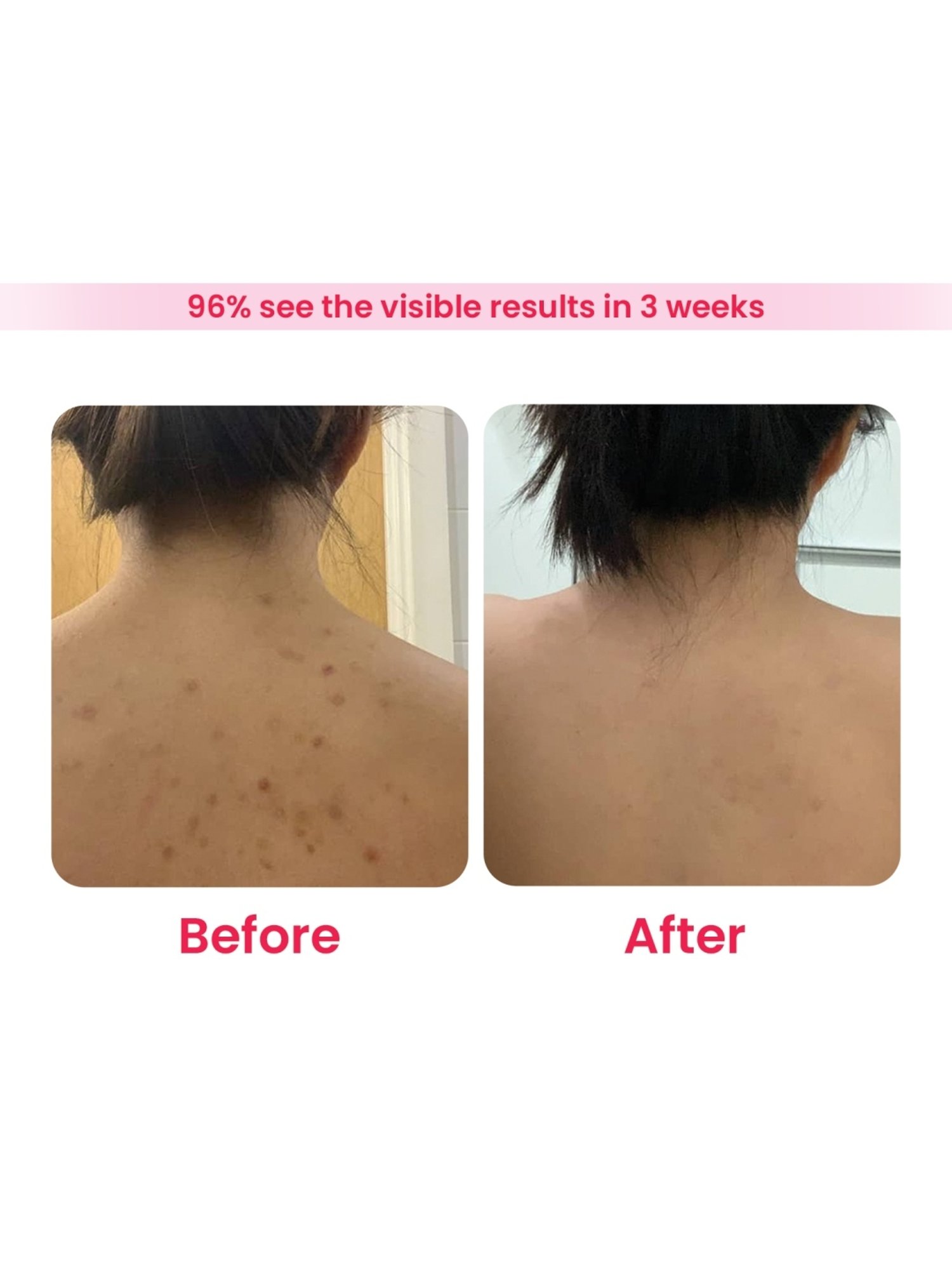 Earthraga HA + Retinol Body Wash - 200 ml