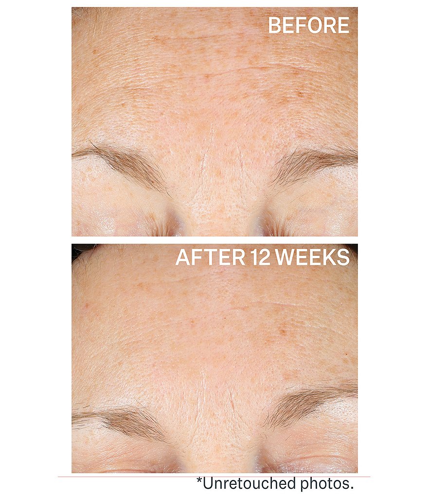 StriVectin SUPER-C RETINOL Brighten & Correct Vitamin C Serum