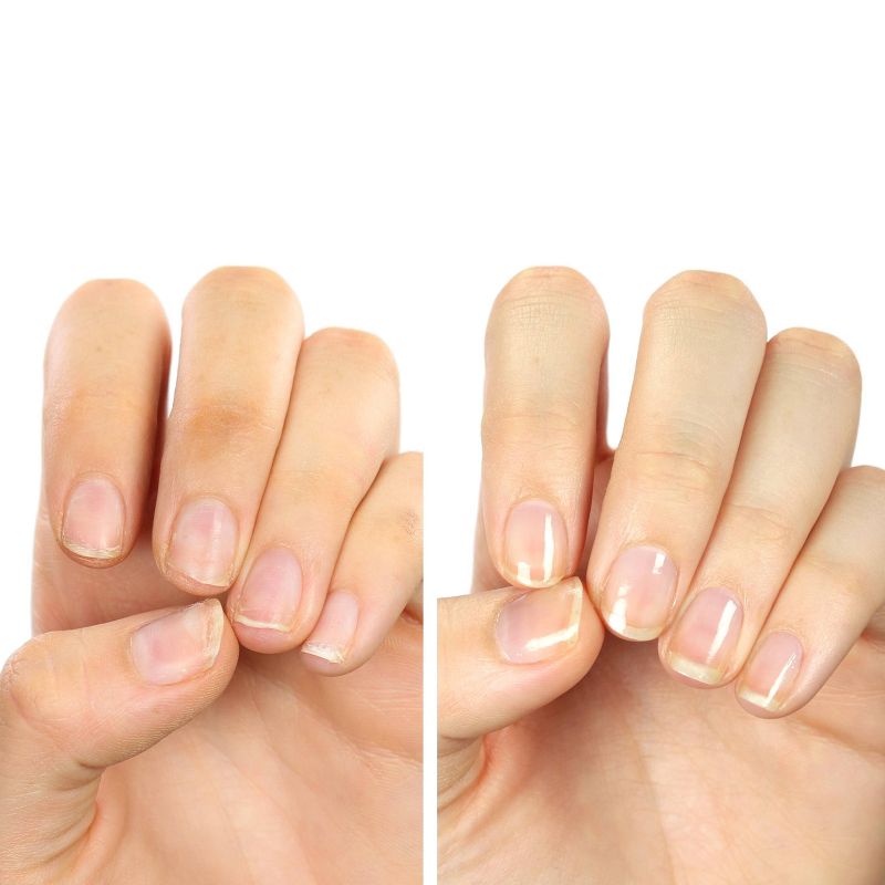 ella+mila Nail Care Treatment - First Aid Kiss - 2pk