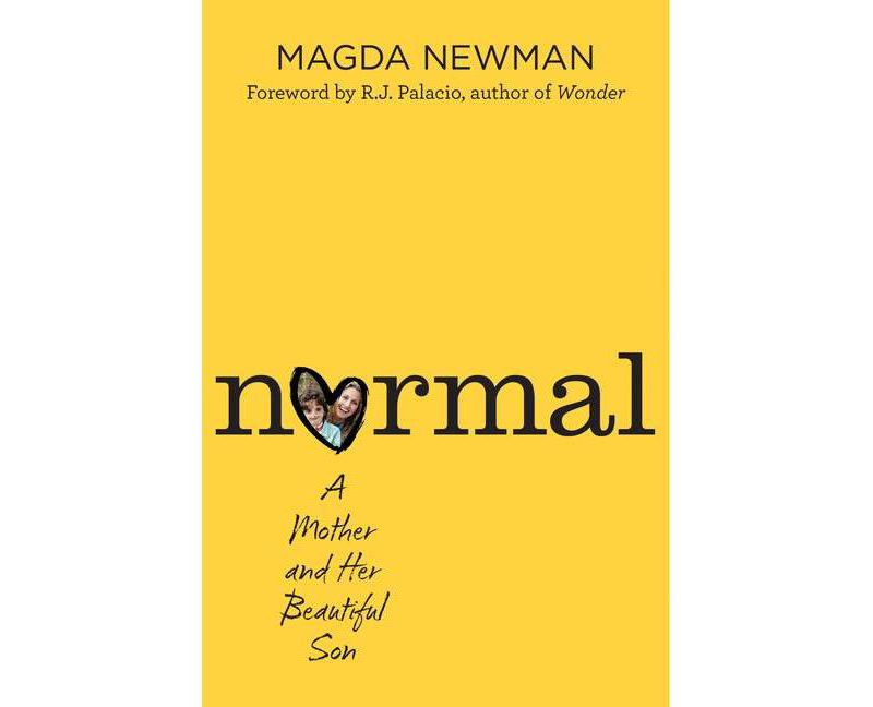 Normal - by  Magdalena Newman (Hardcover)