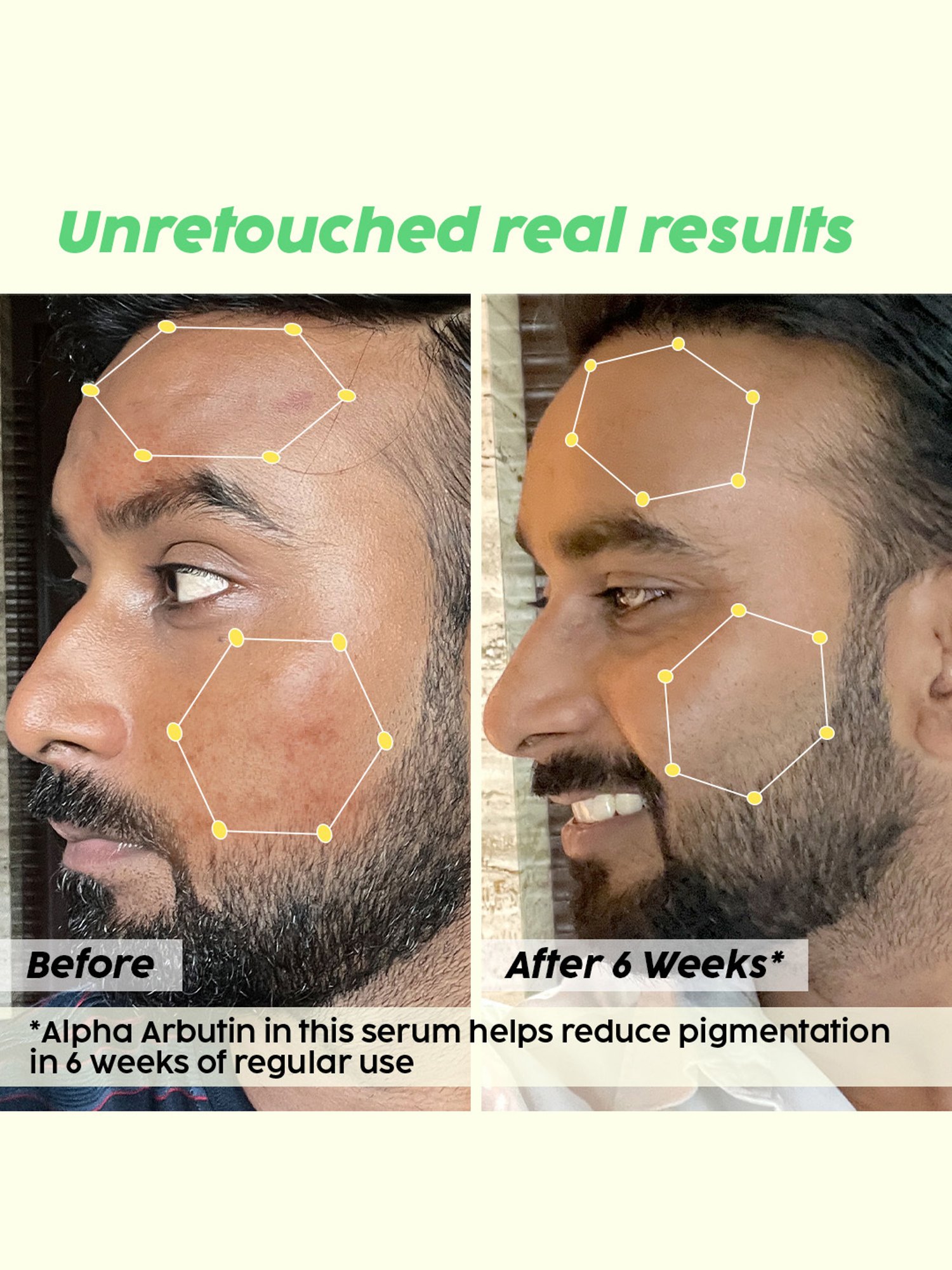 PLIX THE PLANT FIX Pineapple De-Pigmentation Dewy Serum - 30 ml