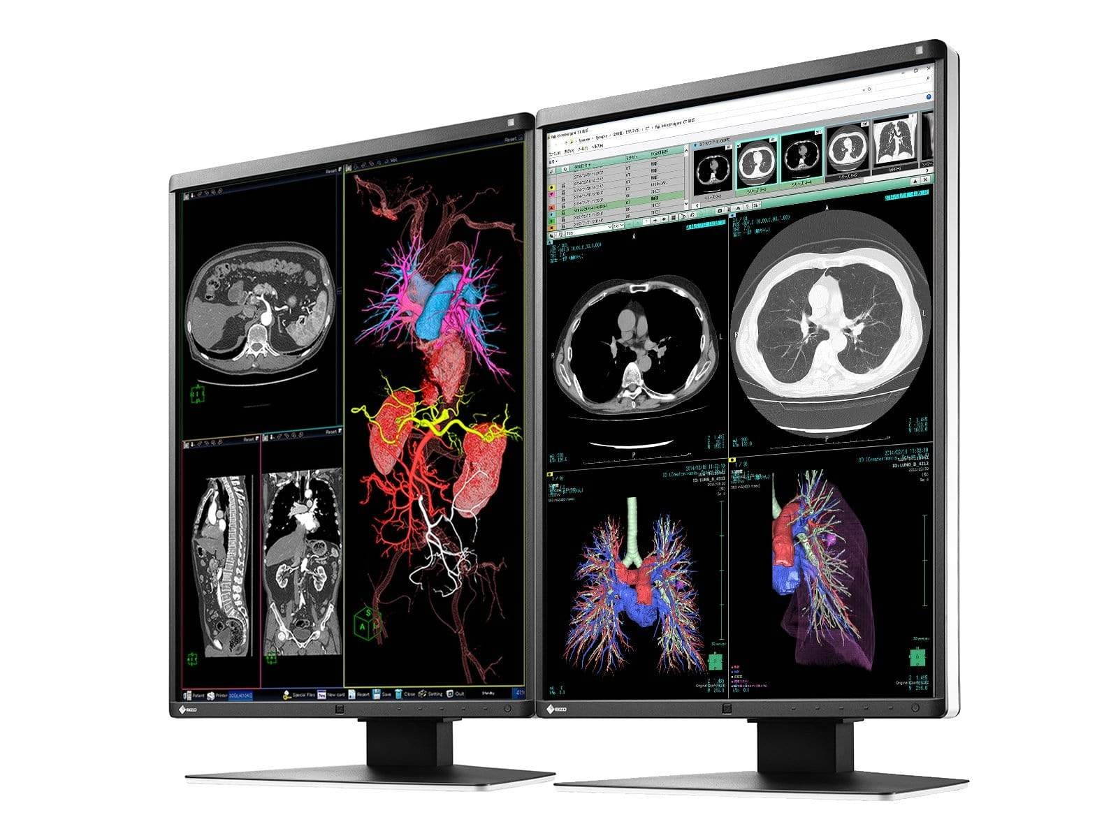 Pair (x2) Eizo RadiForce RX360 3MP Color Medical Diagnostic Radiology Monitors (RX360)