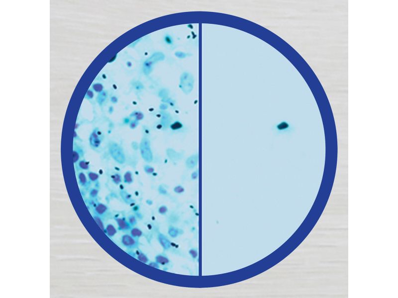 CLR Mold & Mildew Remover - 32 fl oz