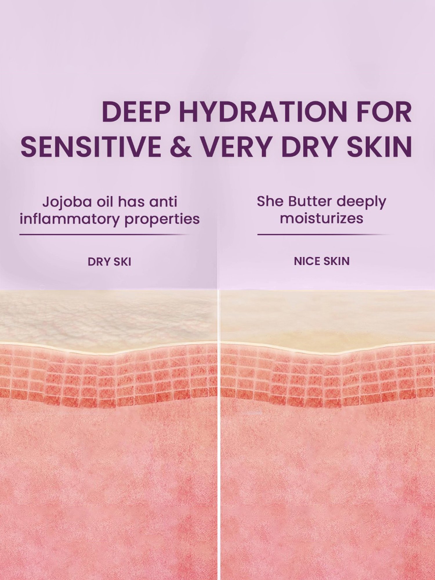 The Skin Story Intense Relief Therapy Cream for Extreme Dry & Sensitive Skin - 45 gm