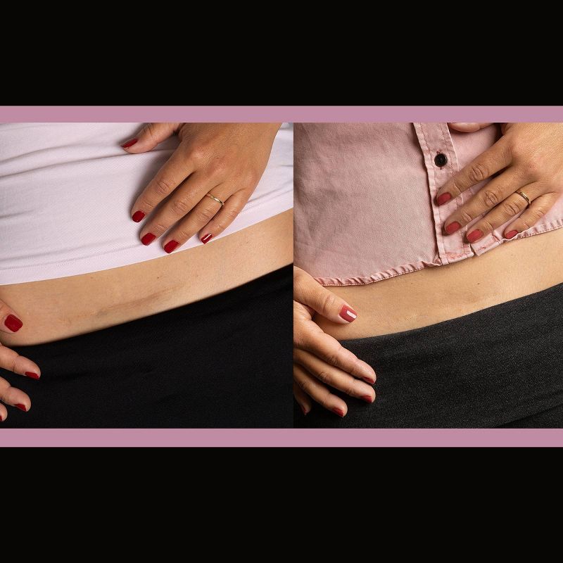 ScarAway Scar Treatment Silicone Sheet 1.5x7 - 4ct