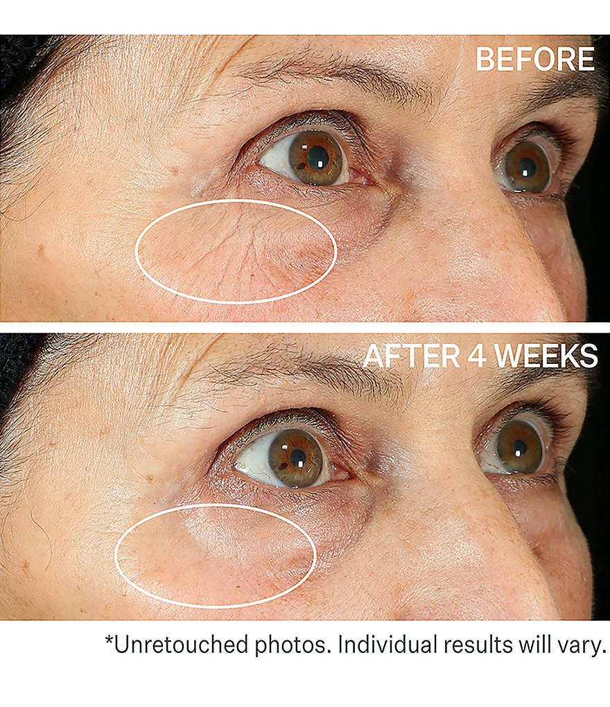 StriVectin Peptight&trade; 360&deg; Tightening Eye Serum