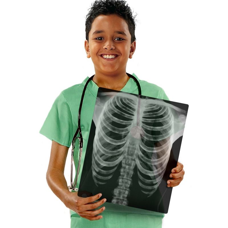 Royclo Human X-Rays on Film