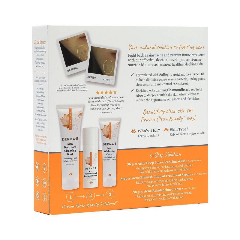 DERMA E Anti-Acne Kit - 3pk