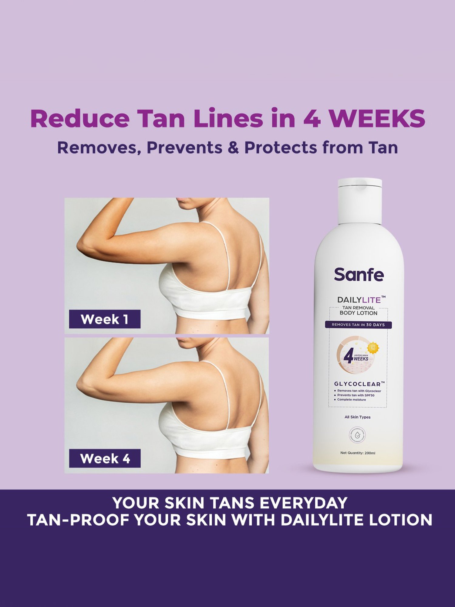 Sanfe Dailylite Tan Removal Body Lotion with SPF 30 - 200 ml