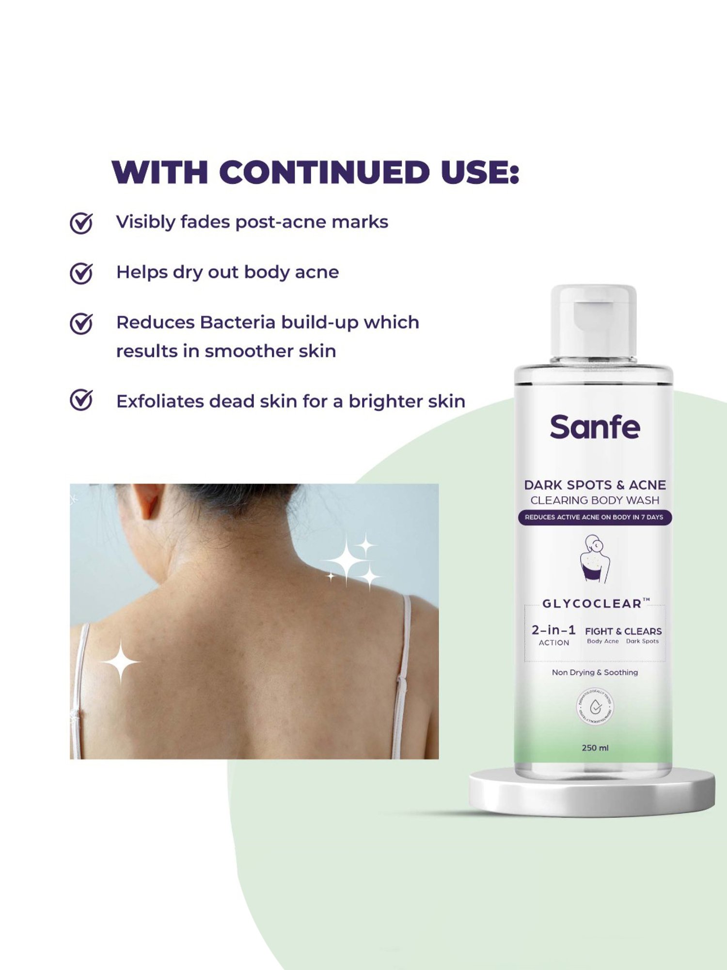 Sanfe Dark Spots & Acne Clearing Body Wash - 250 ml