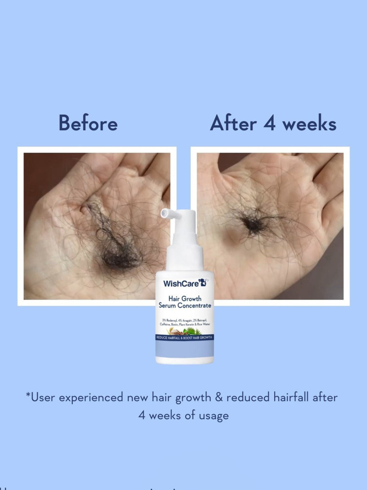 Wishcare Hair Growth Serum Concentrate - 30 ml