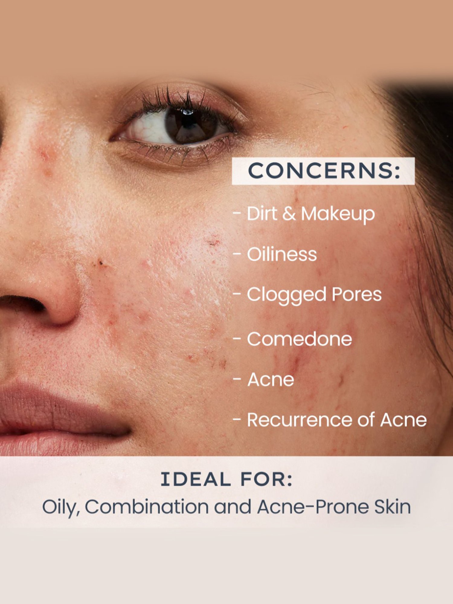 Hyphen Oil Control Daily Exfoliating Cleanser - 100 ml