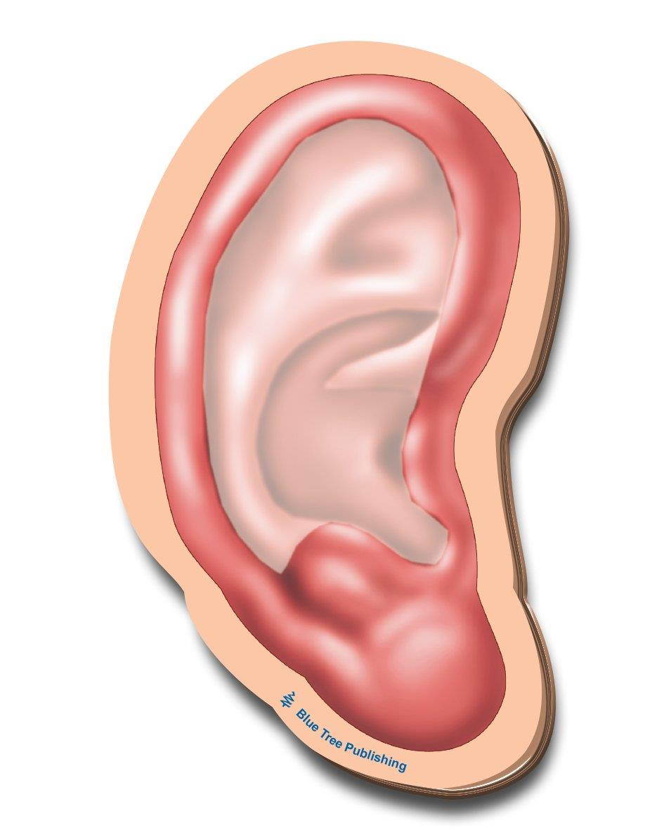 Ear Sticky Notes, 2 Pack-100 Sheets Per Pack