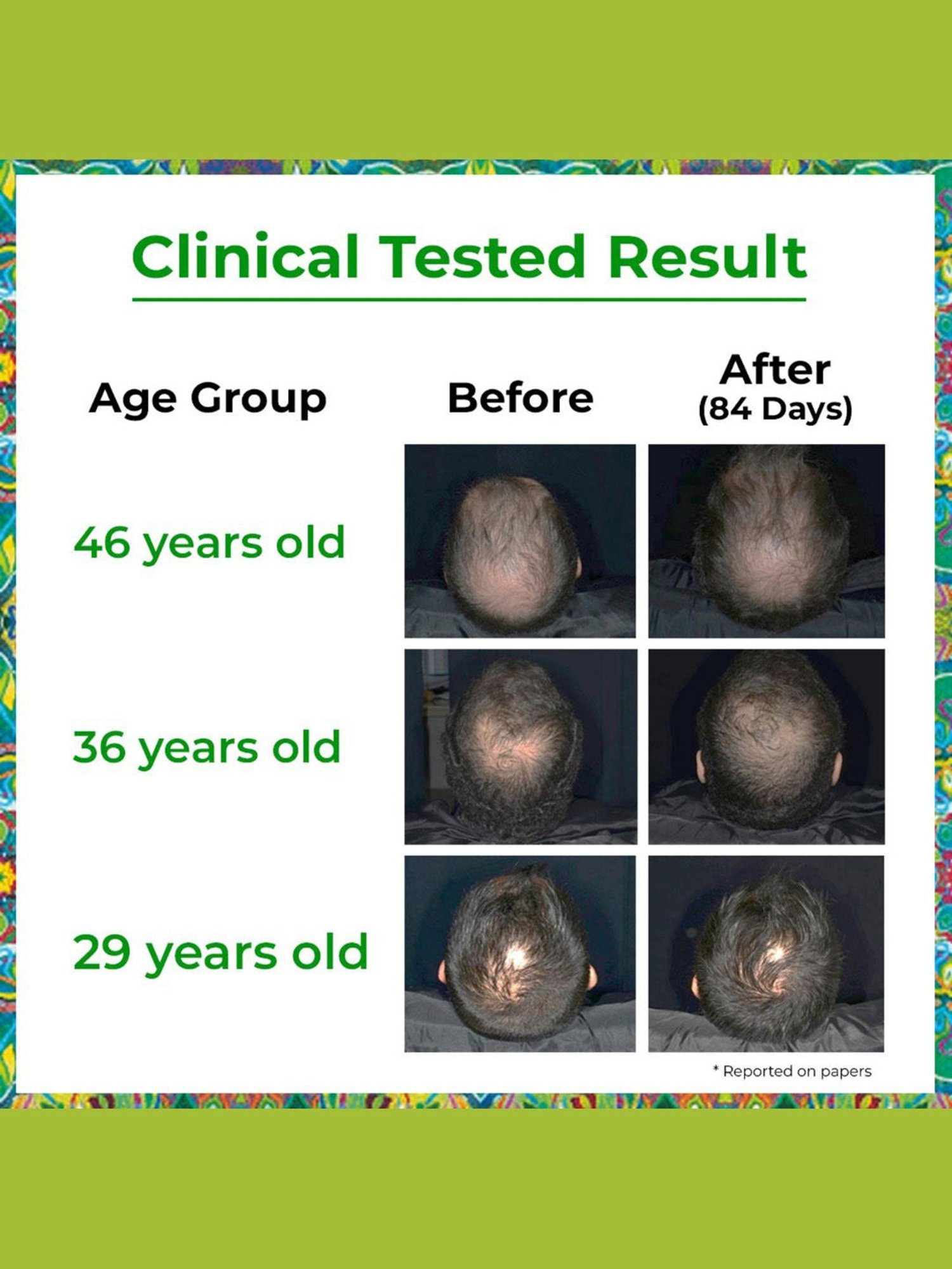 Passion Indulge Hair Growth Activator Water Based Serum - 50 ml