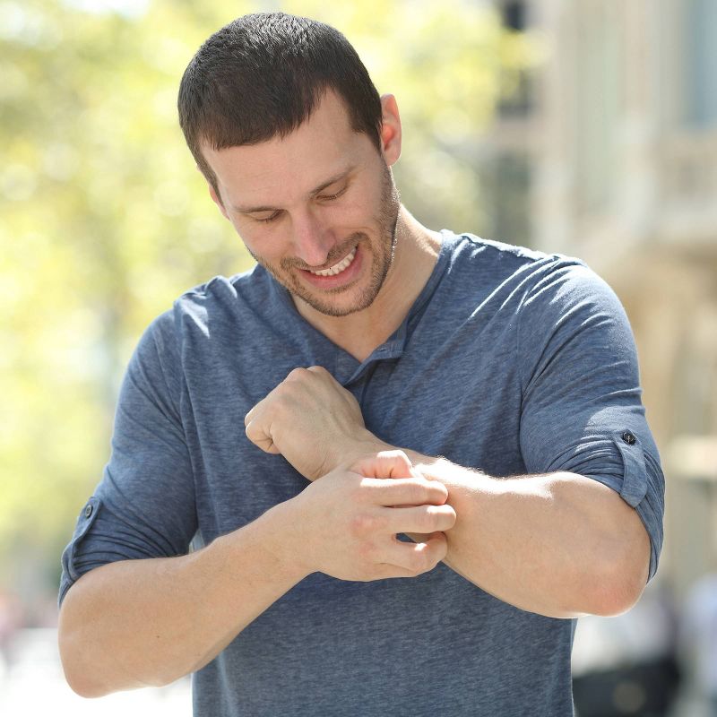 Hydrocortisone Intensive Healing - 2oz - up & up™