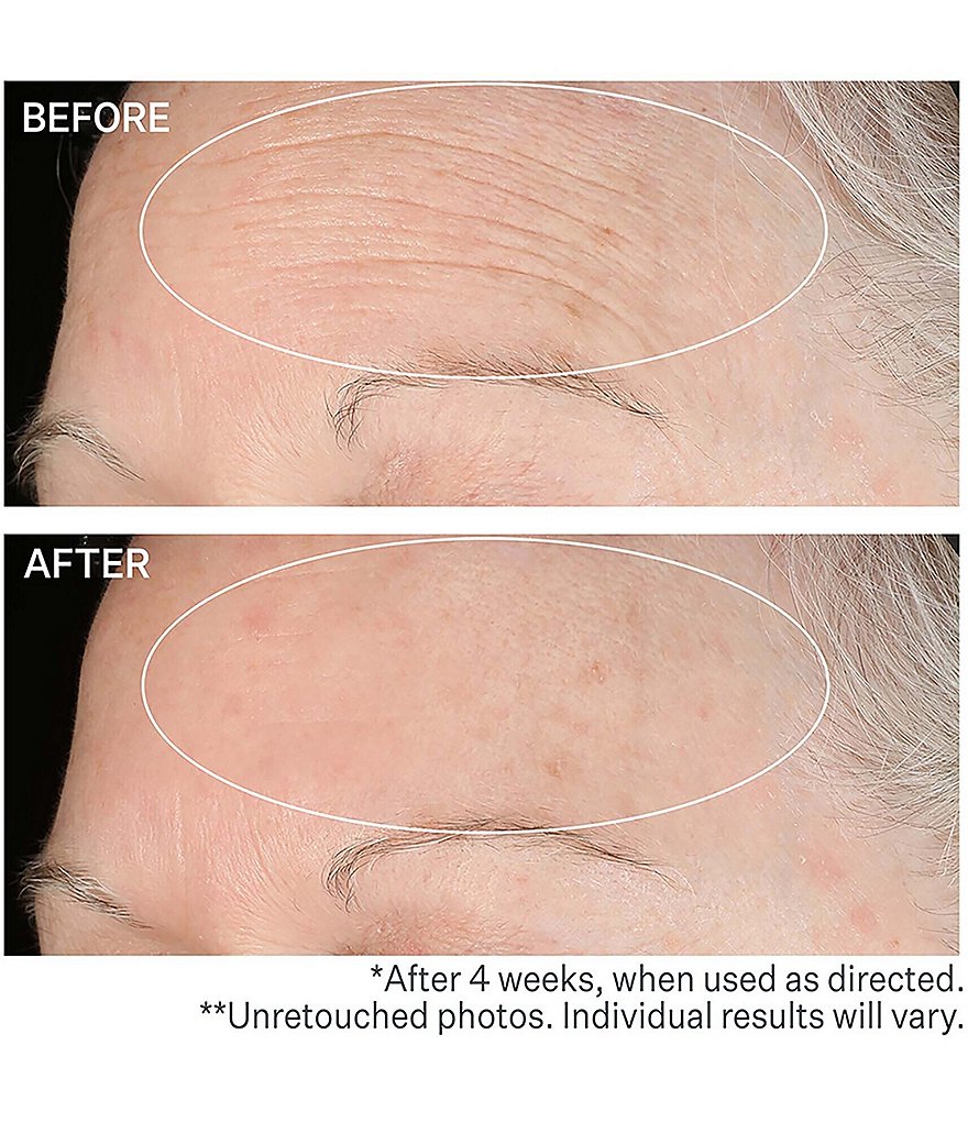 StriVectin SD Advanced&trade; PLUS Intensive Moisturizing Concentrate, 4 oz.