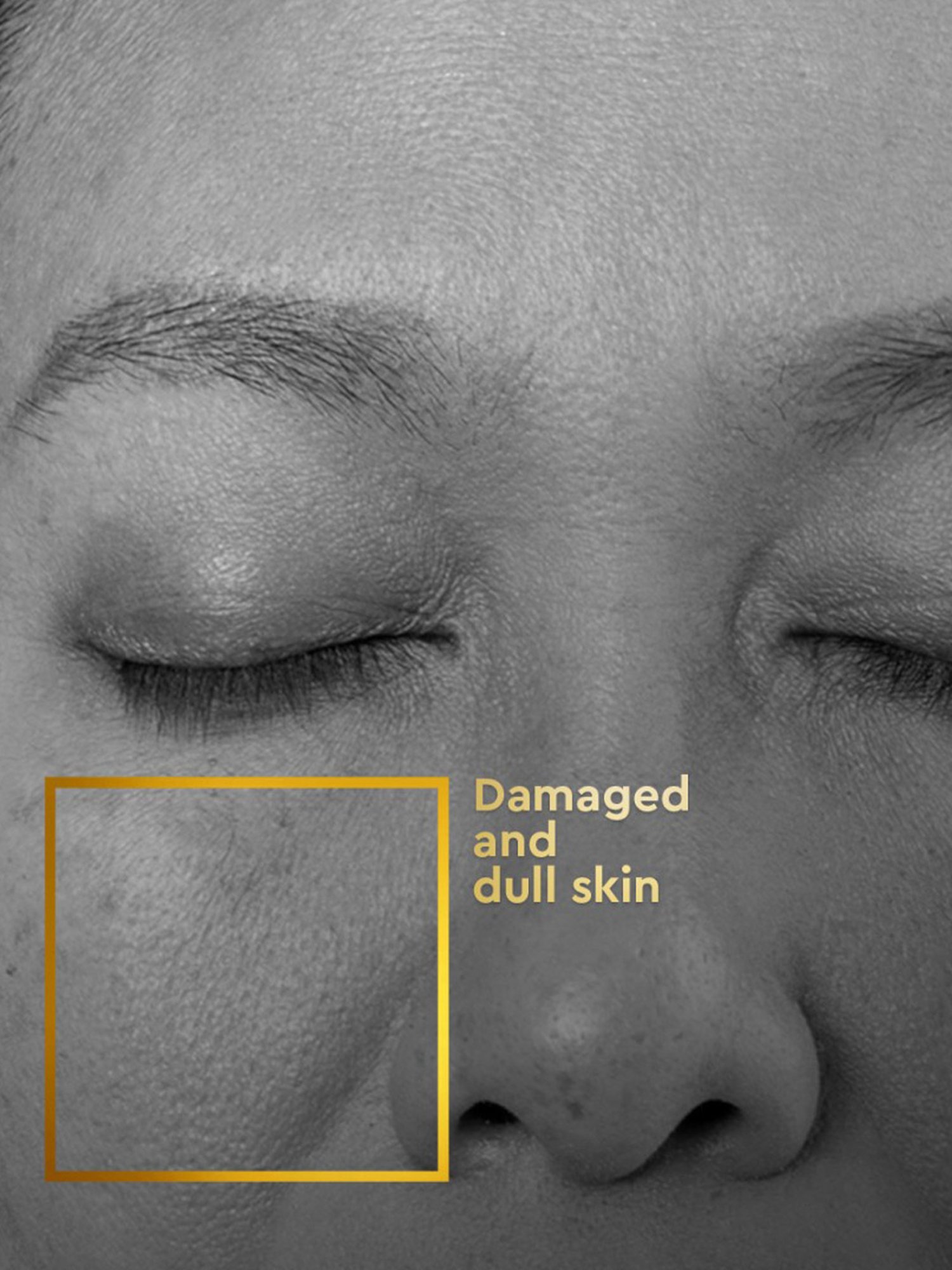 VLCC Clinic ProRescue Micro Serum - 30 ml