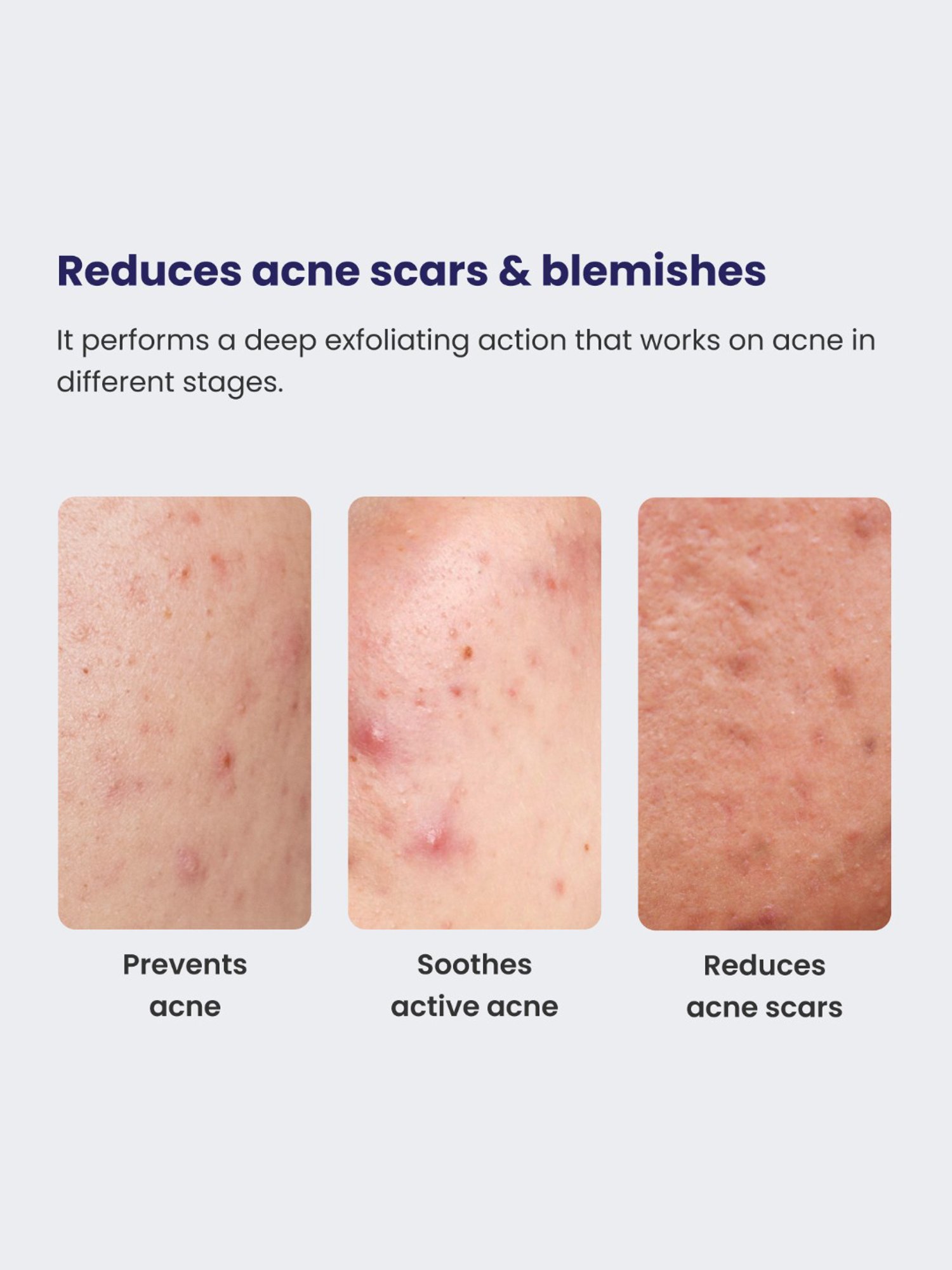 Biotique Wheatgerm Anti-Ageing Night Cream - 50 gm