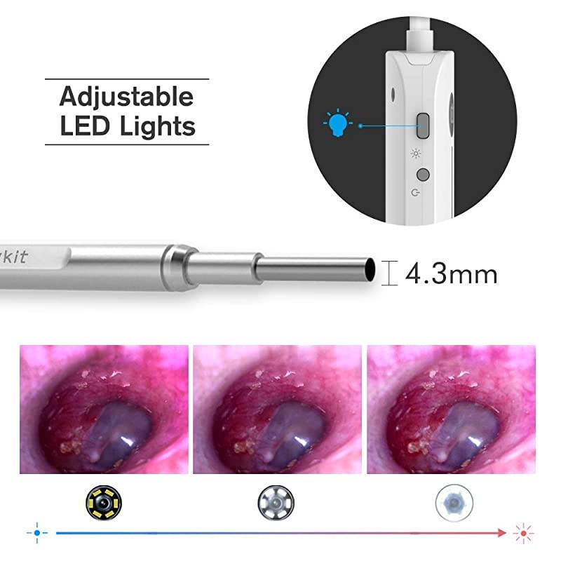 Otoscope iPhone  Upgraded 43mm 720P HD Ear Scope Camera Digital Otoscope with 6 LED Lights Earwax Removal Tool and Specula for iPhone and Android Smartphone