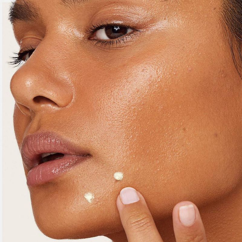 Versed Game Over Acne Drying Treatment - 0.5 fl oz