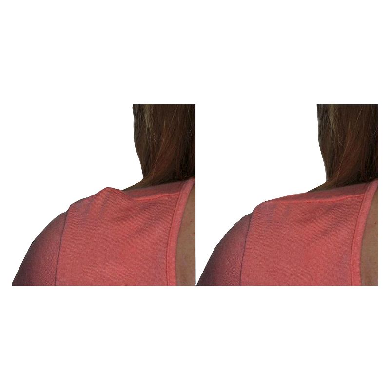 Bumps Be-Gone 10pk Hangers Blue