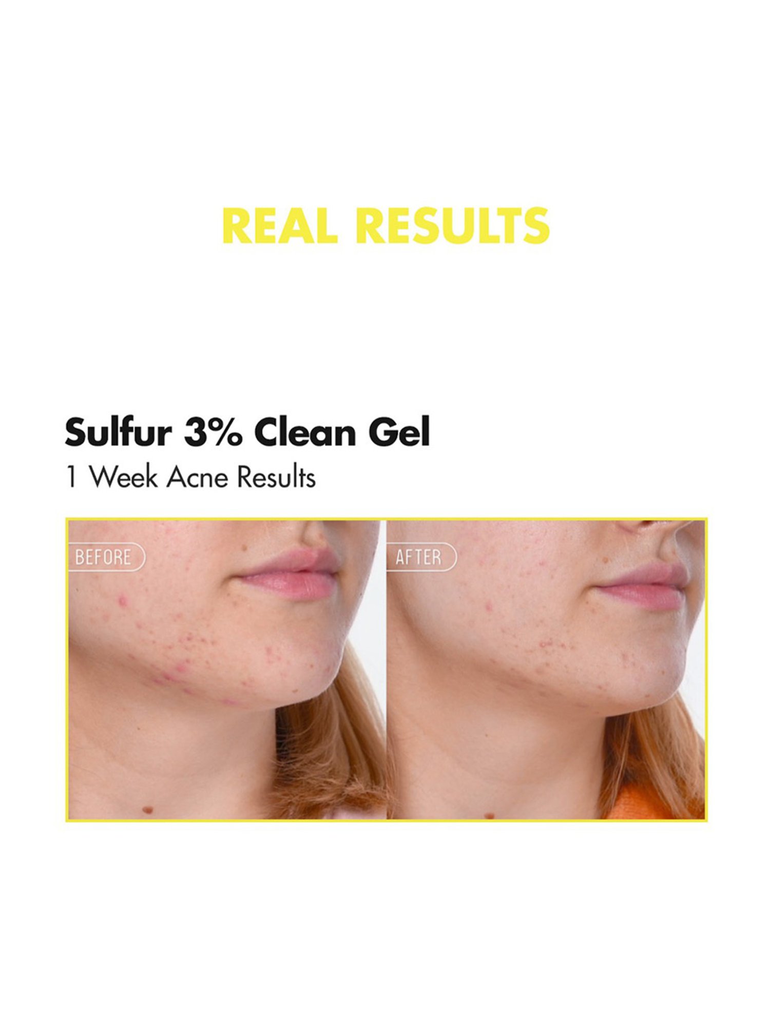 By Wishtrend Sulfur 3% Clean Gel - 30 gm