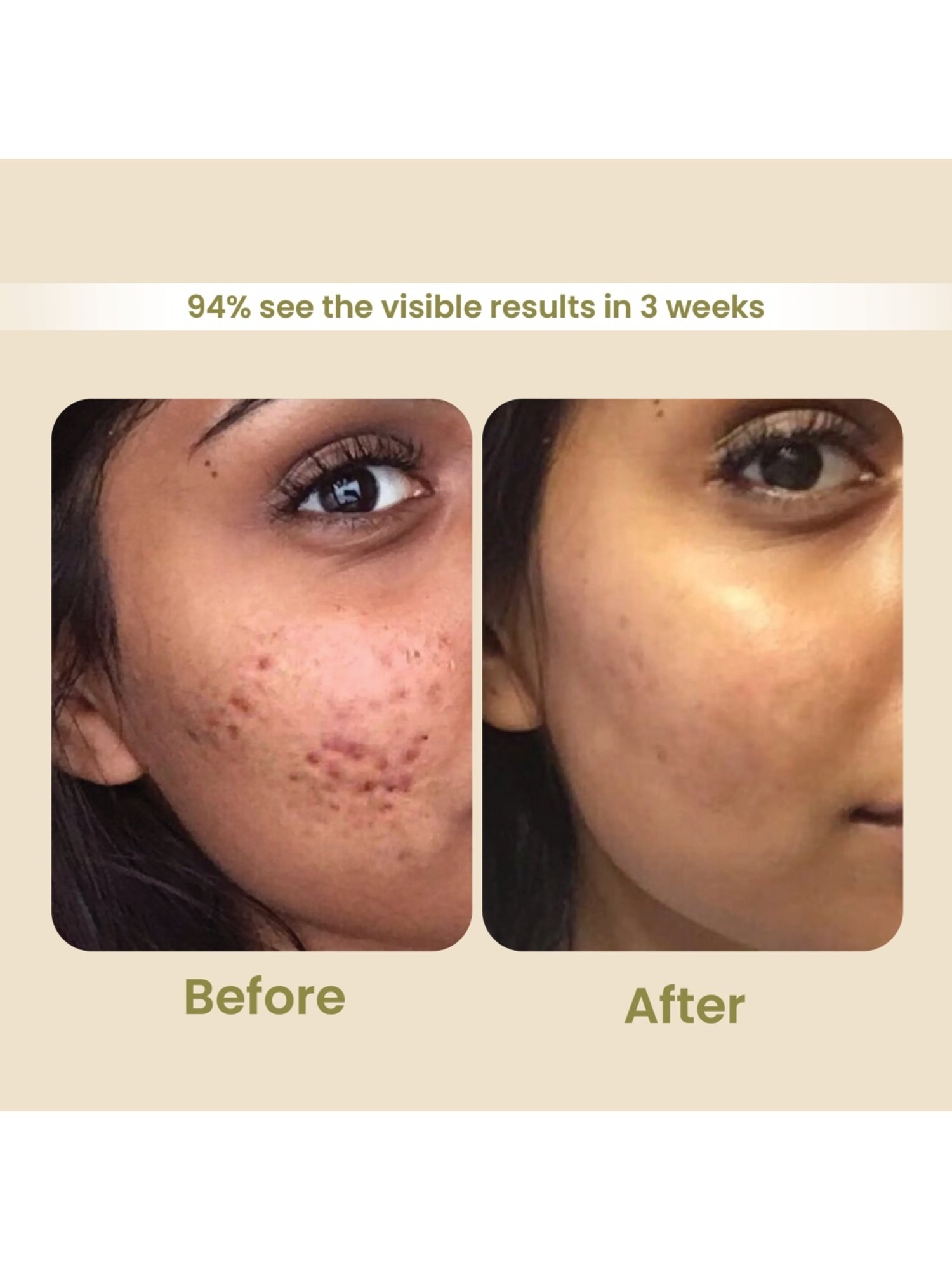 Earthraga Deep Cleansing Salicylic Acid + Coffee Face Wash - 100 ml