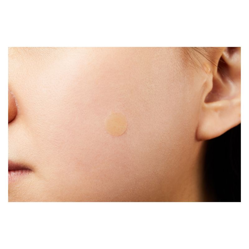 COSRX Patch Anti-acne Facial Treatment - 18ct