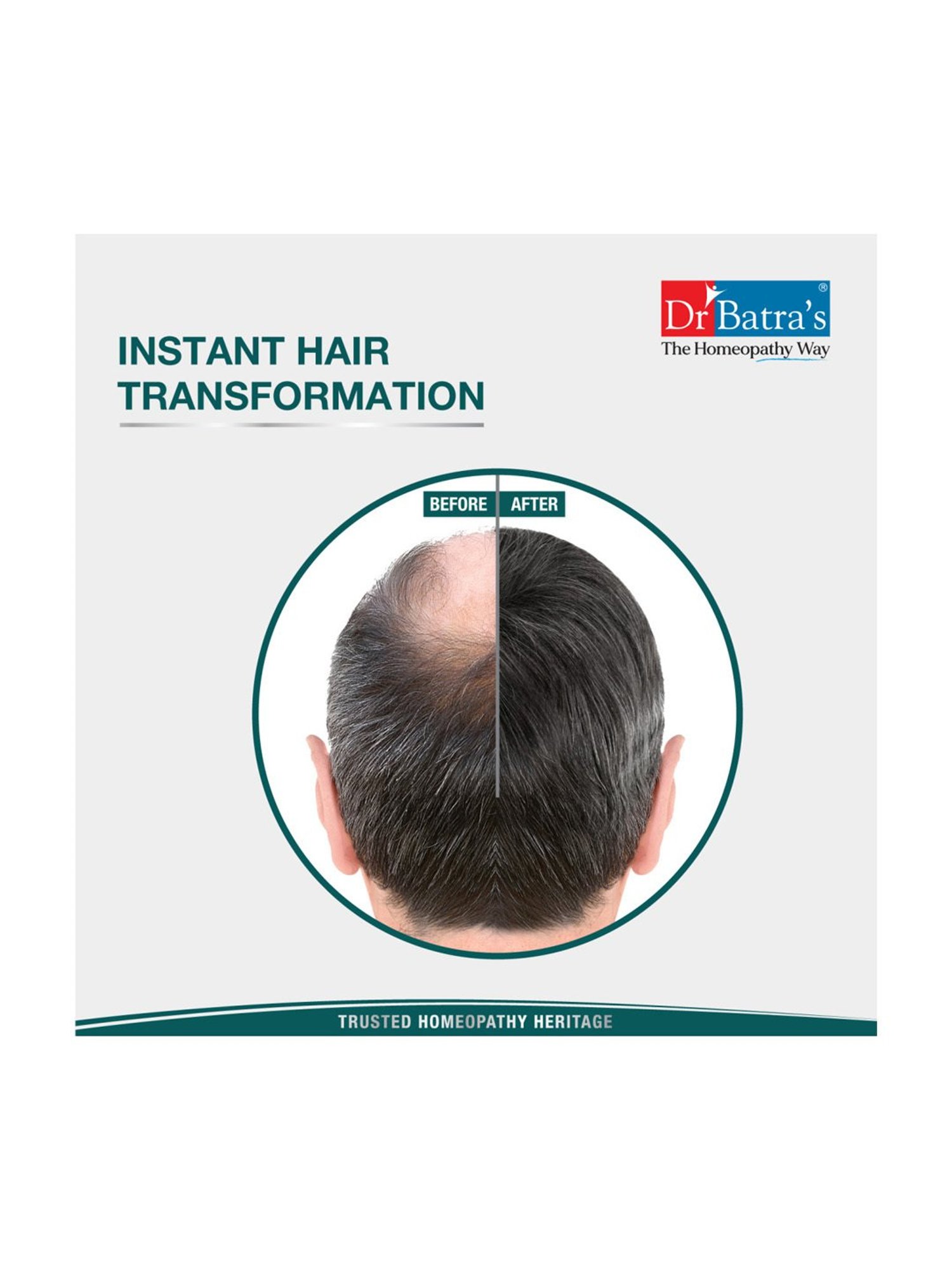 Dr. Batra's Instant Hair Natural Keratin Hair Building Fibre Black - 12 gm